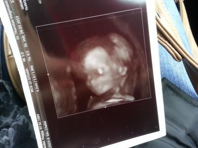 Bild zu heute 1 triimester screening gehabt +4d bilder - Forum für Oktober - Mamis