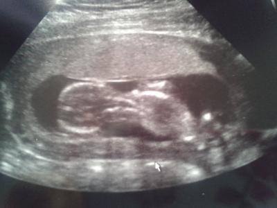 Bild zu Zurück vom FA :):):):):):):) - Forum für Oktober - Mamis