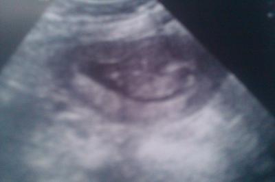 Bild zu zurück vom baby tv - Forum für Oktober - Mamis