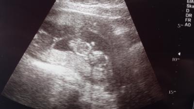 Bild zu zurück von der FÄ - Forum für Oktober - Mamis