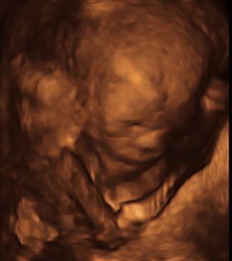 Bild zu Endlich Bericht mit Fotos... - Forum für Oktober - Mamis