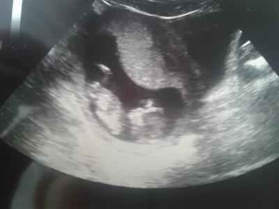 Bild zu < 3 Mein BABY winkt mir zu ;-)) - Forum für Oktober - Mamis