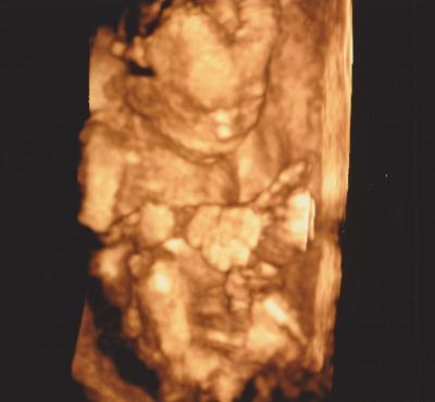 Bild zu Outing beim 4D-Ultraschall gestern :-) - Forum für Oktober - Mamis