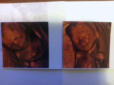 Bild zu unser bauchzwerg wird ein... - Forum für Oktober - Mamis