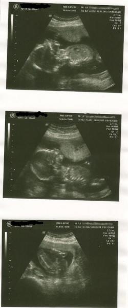 Bild zu US-Bilder und Frage - Forum für Oktober - Mamis