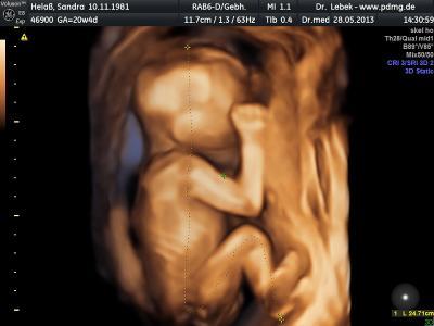 Bild zu und ein foto hinterher..... - Forum für Oktober - Mamis