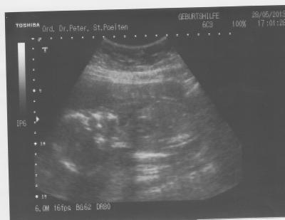 Bild zu Zurück vom FA :-) - Forum für Oktober - Mamis