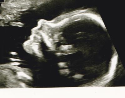 Bild zu Meine kleine - Forum für Oktober - Mamis