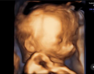 Bild zu unser US-bild als punker - Forum für Oktober - Mamis