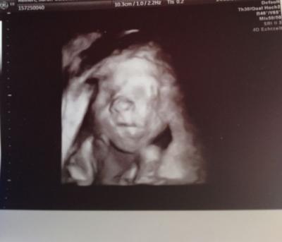 Bild zu Bericht FD 2. Teil von gestern :) - Forum für Oktober - Mamis