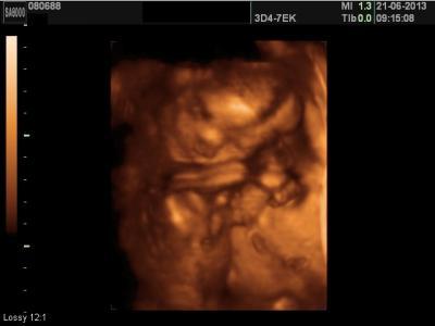 Bild zu Bitte schaut euch das 3D Bild auch mal :-/ - Forum für Oktober - Mamis