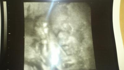 Bild zu Bericht vom FA Termin :-) - Forum für Oktober - Mamis