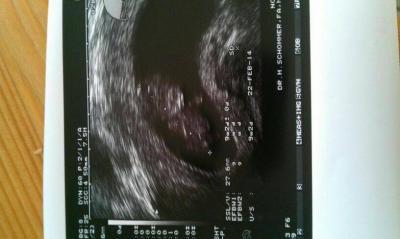 Bild zu Frauenarztbericht - Forum für Oktober - Mamis