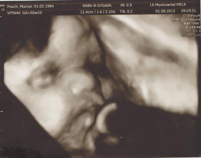 Bild zu Bericht vom heutigen Termin! mit Bildchen :-) - Forum für Oktober - Mamis