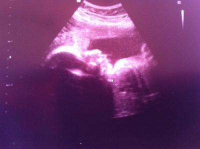 Bild zu FA- Bericht von gestern. - Forum für Oktober - Mamis