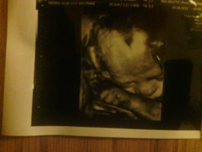 Bild zu war doch beim FA. - Forum für Oktober - Mamis