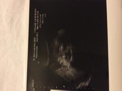 Bild zu Was würdet ihr sagen?? Mädchen o. Junge? - Forum für Oktober - Mamis