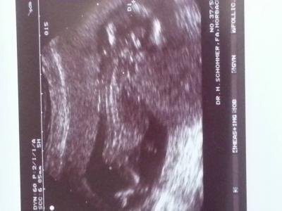 Bild zu Frauenarztbericht von gestern - Forum für Oktober - Mamis