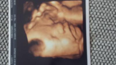 Bild zu Hier mal unser kleiner Schatz ... - Forum für Oktober - Mamis