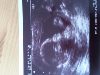 Bild zu Frauenarztbericht - Forum für Oktober - Mamis