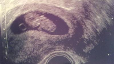 Bild zu FA-Besuch gestern - Forum für Oktober - Mamis