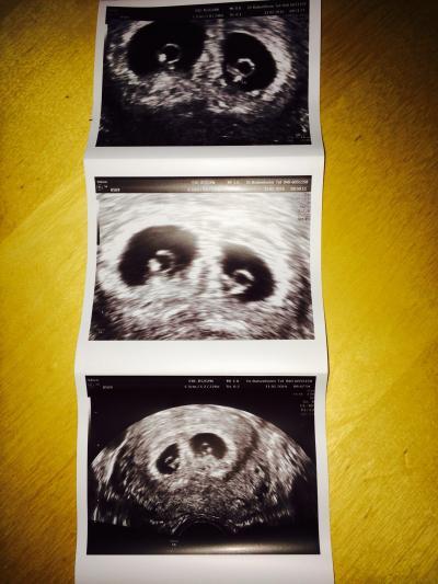 Bild zu Zurück vom FA mit 2 Babys - Forum für Oktober - Mamis