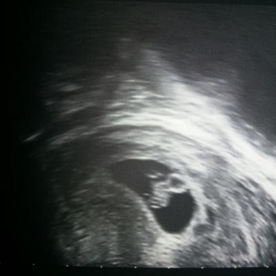 Bild zu Zurück vom Fa - Forum für Oktober - Mamis