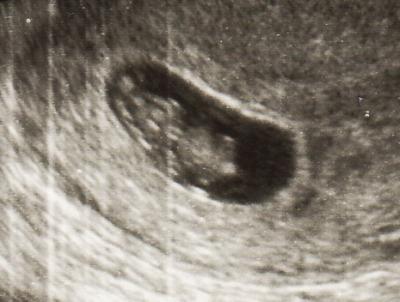 Bild zu Alles gut und das Herzchen bubberte - Forum für Oktober - Mamis
