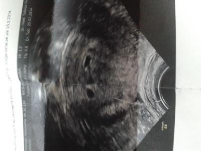 Bild zu bild geht jetzt :) - Forum für Oktober - Mamis