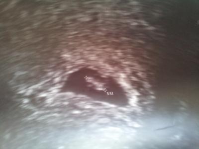 Bild zu darf ich euch jemanden vorstellen? - Forum für Oktober - Mamis