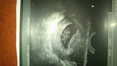 Bild zu ok dann stelle ich meinen krümel auch mal vor - Forum für Oktober - Mamis