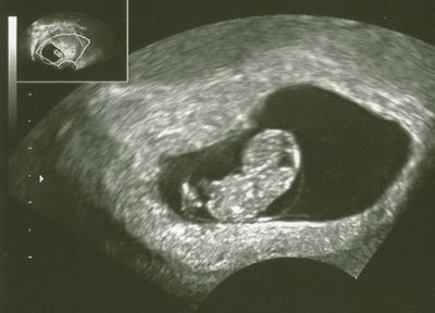 Bild zu Überglücklich zurück vom FA! :D - Forum für Oktober - Mamis