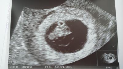Bild zu mein Krümel :-) - Forum für Oktober - Mamis