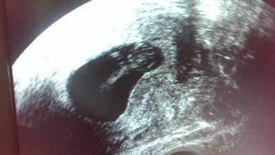 Bild zu ein neues Bild vom krümmel :) - Forum für Oktober - Mamis