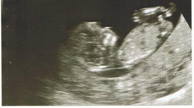 Bild zu Zurück vom FA und stolz wie Oskar :) - Forum für Oktober - Mamis