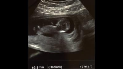 Bild zu Update - bin zurück aus dem KH - Forum für Oktober - Mamis