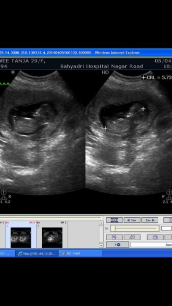 Bild zu endlich bilder - Forum für Oktober - Mamis