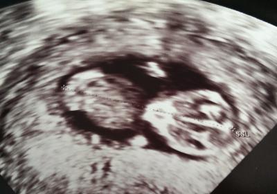 Bild zu hier noch das bild :) - Forum für Oktober - Mamis