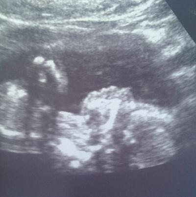 Bild zu Bin wieder da vom FA - Forum für Oktober - Mamis