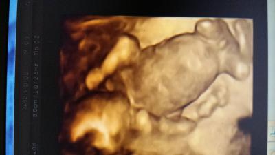 Bild zu unsicher - Forum für Oktober - Mamis