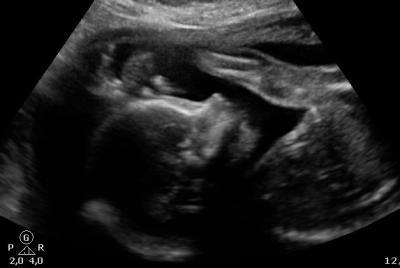 Bild zu Und plötzlich war er weg... - Forum für Oktober - Mamis