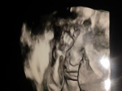 Bild zu auch zurück - Forum für Oktober - Mamis
