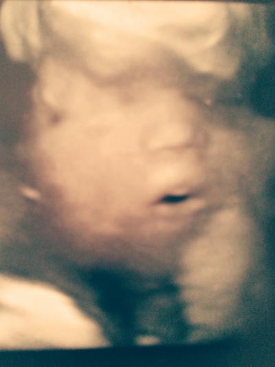 Bild zu Endlich ein 3D Bild von unserer Prinzessin - Forum für Oktober - Mamis