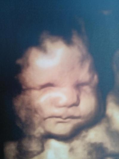 Bild zu 3D Bild und großes schweres Baby =D - Forum für Oktober - Mamis