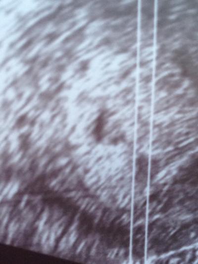 Bild zu Erstmal huhuuu und zurück vom Gyn ... - Forum für Oktober - Mamis