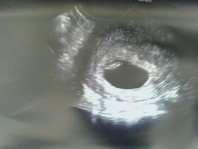 Bild zu Juchuh!!!!!!!!! - Forum für Oktober - Mamis