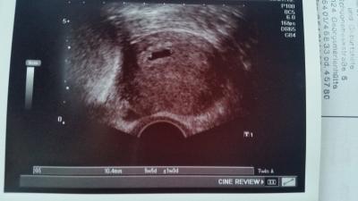 Bild zu Alles gut :) - Forum für Oktober - Mamis