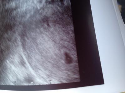 Bild zu Tadaaaaaaaa < 3 happy - Forum für Oktober - Mamis
