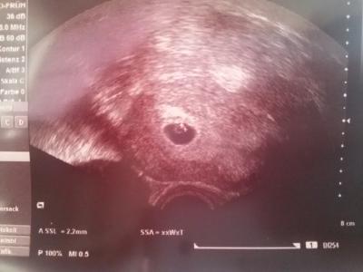 Bild zu zurück vom FA :) - Forum für Oktober - Mamis
