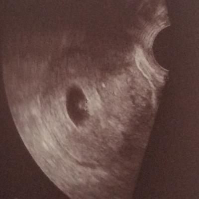 Bild zu Voller Stolz präsentierte ich ... - Forum für Oktober - Mamis